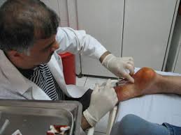 Topuk Ameliyati Riskleri Ve Sonrasi Ameliyatlar Gen Tr