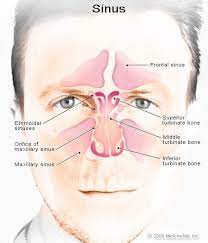 What a deviated septum looks like. Nasal Airway Surgery Septoplasty Procedure Complications Recovery