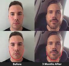 We did not find results for: 10 Best Jawline Exercise Ideas Jawline Exercise Jawline Exercise