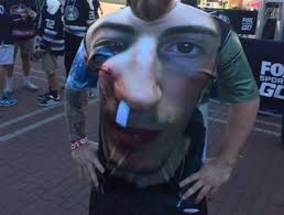 Here's zach werenski back on the ice for the #cbj, wearing a full face shield. Columbus Fan S Shirt Features Werenski S Beat Up Face Thescore Com