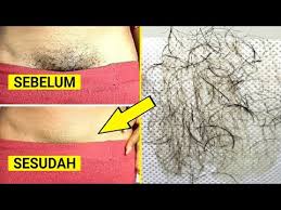 Mencukur bulu kemaluan memerlukan cara tertentu agar tidak menyebabkan luka. Cukur Bulu Tanpa Gatal How To Keep Pubic Area From Itching After Shaving Sex Education Vidoemo Emotional Video Unity