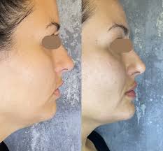 wrapped in a bow #fireworks #lanadelrey #bow