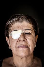 Protesterna i Chile: De förlorade synen