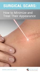Pin On Plastic Surgery Articles