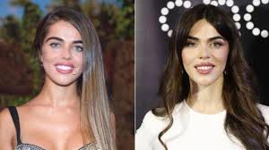 Qué se ha hecho Violeta Mangriñán en la cara: los retoques estéticos que han mejorado su rostro