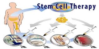 Scientific studies show that also stem cell transform into new hair follicle cells. Read Cost Of Stem Cell Therapy For Hair Loss In India Online Free Yudu