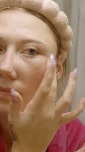 My conditions make me 1 in a trillion 😳 #fbreels #borndifferent  #fibrousdysplasia #mccunealbrightsyndrome #selfconfidence