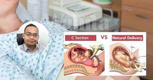 Jika anda bersalin secara pembedahan, saya kongsikan sedikit tips untuk anda amalkan semasa dalam proses berpantang. Rahim Pecah Antara Risiko Bersalin Normal Selepas Ada 1 Pembedahan Caesarean Mingguan Wanita