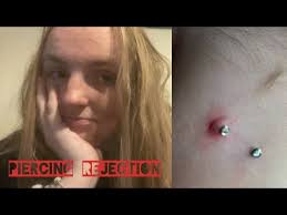 Halloween Dermal Rejection!!!