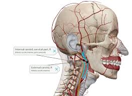 Image result for carotid artery