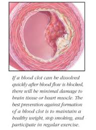 That means you need to try to eat the same amount of leafy green vegetables,. Blood Clots