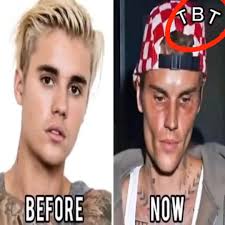 🥺Justin Bieber admits that he tested positive for…See More