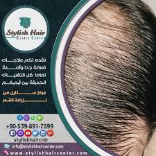 تعاني تساقط الشعر بشكل ملحوظ الآن نوظف تقنيات الطب الحديثة في كافة عمليات زراعة الشعر لجميع الحالات بلا استثناء تقنية الاقتطا Hair Clinic Stylish Hair Hair