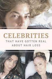 I can't say that i've been astounded by the growth as such, but my hair definitely feels better. not only is it helping my hair grow, my hair constantly feels amazing and healthy. These Celebrities Have Gotten Real About Hair Loss Hair Loss Awareness Hair Loss Women Female Celebrities Hair
