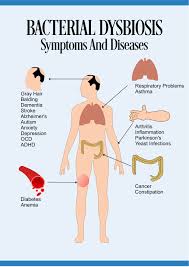 Cleanse Your Colon The Definitive Guide Share Tweet Share Share A Guide On How To Cleanse Your Colon Healthy Gut Bacteria Candida Overgrowth Yeast Infection