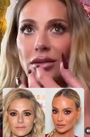 Cosmetic Surgery and Public Figures' Appearances