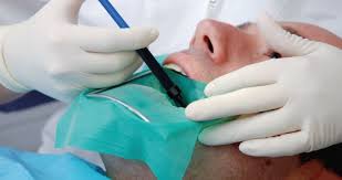 Never ignore a problem of this type. Controversial Tv Show On Root Canal Treatment Pulled British Dental Journal