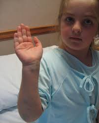 SWIPEEEEE🥰I love seeing how much more mature and confident i have become  as a woman❤️Living with a visible difference can be difficult, but I have  really found a way to become more