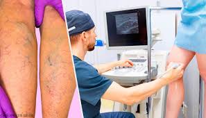 A febre na leucemia pode ser causada por uma infecção oportunista que se aproveita do fato dos leucócitos estarem doentes e incapazes de defender o organismo. 10 Sintomas Da Leucemia Que Costumam Passar Despercebidos Melhor Com Saude