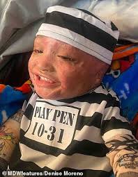 Two-year-old survives house fire with horrific burns across 95% of his body 