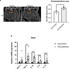 IL-1β and TNF-α play an important role in modulating the risk of  periodontitis and Alzheimer's disease
