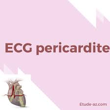 Les infos, chiffres, immobilier, hotels & le mag. Ecg Pericardite Pdf Etude Az
