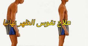 أفضل تمارين لتقوس الظهر بالصور تمارين تصحيح تقوس الظهر