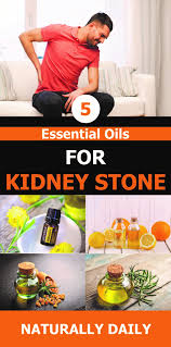 Pin On Kidney Stones