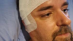 Fundraiser for Shaun Cain by Jessica Loughrey : Support Shaun's Fight  Against Glioblastoma