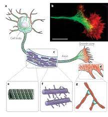Most of the analysis is done on whole urine (as it comes from the animal), but the microscopic examination of cells and solid material requires the sample to be concentrated or sedimented. What Intracellular Structure Helps Animal Cells To Maintain Their Shape Quora