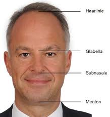 Langzeitergebnisse der Septorhinoplastik