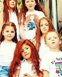 Ginger Armenian Children Redhead Armenians Armenian Redheads Armenian Gingers People Of The World Photo Armenia