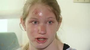 Pokemon Go: Police forces across Canada warn of risks involved with playing 