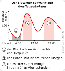 Schwerer bluthochdruck (grad 3) 180 und mehr: Schwankender Blutdruck Meist Normal Aber Manchmal Gefahrlich Blutdruck Medizin