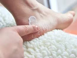 Gently pat your feet dry. Cure Cracked Heels 4 Easy Remedies To Cure Cracked Heels Using Home Ingredients How To Treat Crack Heels At Home