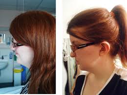 Cleft Lip Palate Association