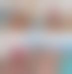 Image result for paraphimosis