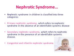 A physical exam by your child's nephrologist we treat nephrotic syndrome in 3 ways: Glomerular Diseases In Pediatrics Ppt Download