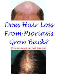 1 there are several possible causes for cat hair loss, most easily treatable. What Can Cause Hair Loss In A Woman Cat Skin Problems Hair Loss Hair Loss Conference 2017 Maca Powder Hair Loss Hair Loss Pills Body Hair Loss Hair Loss Cure