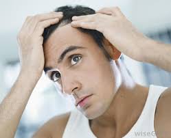 Ammonia and hydrogen peroxide do this, too, and weaken your hair shafts, leading to increased breakage. What Is The Connection Between Prednisone And Hair Loss