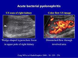 Related Image Ultrasound Radiology Sonography