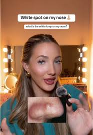 Understanding White Lumps