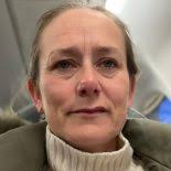 Behandling af ældre og yngre patienter med ovariecancer i Danmark gennem 14  år