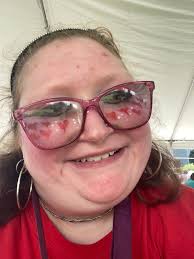 That's me at ADA Day The Disability Network