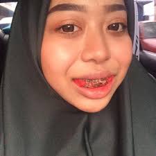 Kisah kehidupan keluarga kerajaan ini jadi tragedi. Penat Diejek Gadis Ini Nekad Pakai Braces Melalui Doktor Bertauliah Hasilnya Senyuman Jadi Cantik Lebih Confident Hijabista