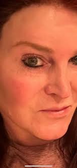 Are you suffering from TIOS [Trump-Induced Obscenity Syndrome]?