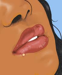 What do ingrown hairs look like? How To Get Rid Of Pimple On Lip Line Vs Herpes Sores