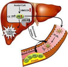 Increased Hepatic Synthesis And Dysregulation Of Cholesterol Metabolism Is Associated With The Severity Of Nonalcoholic Fatty Liver Disease Sciencedirect