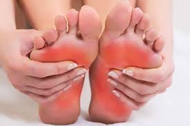 Monturi (hallux valgus), bataturi, metatarsalgii, deformatiile degetelor, hallux rigidus, picior reumatoid. Durerile In TalpÄ IndicÄ AfecÅ£iuni Serioase Si Nu Trebuie Ignorate Ce Probleme De SÄnÄtate Pot Fi Citite In Talpa Piciorului ÈtiinÈa Mister Ro