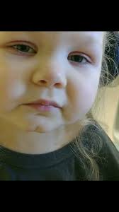 Re-living these post-op experiences is always difficult but, I'm grateful  we were able to get the hard stuff done before she was old enough to  remember much. BUT, we made it through and she is so much ...